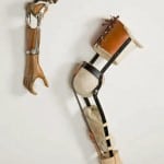 Arm- und Beinprothese, Orthopädische Universitätsklinik Friedrichsheim gGmbH, Frankfurt am Main, Foto: Braunschweigisches Landesmuseum/ P. Sierigk